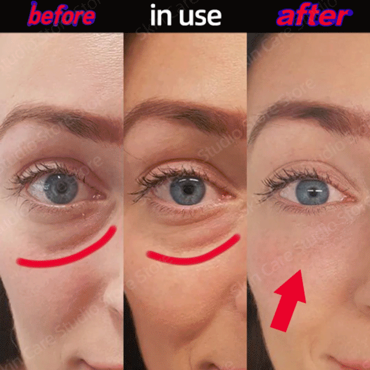 Crème anti-age pour les Yeux