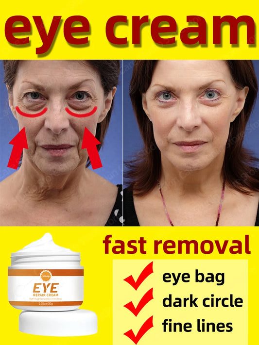 Crème anti-age pour les Yeux